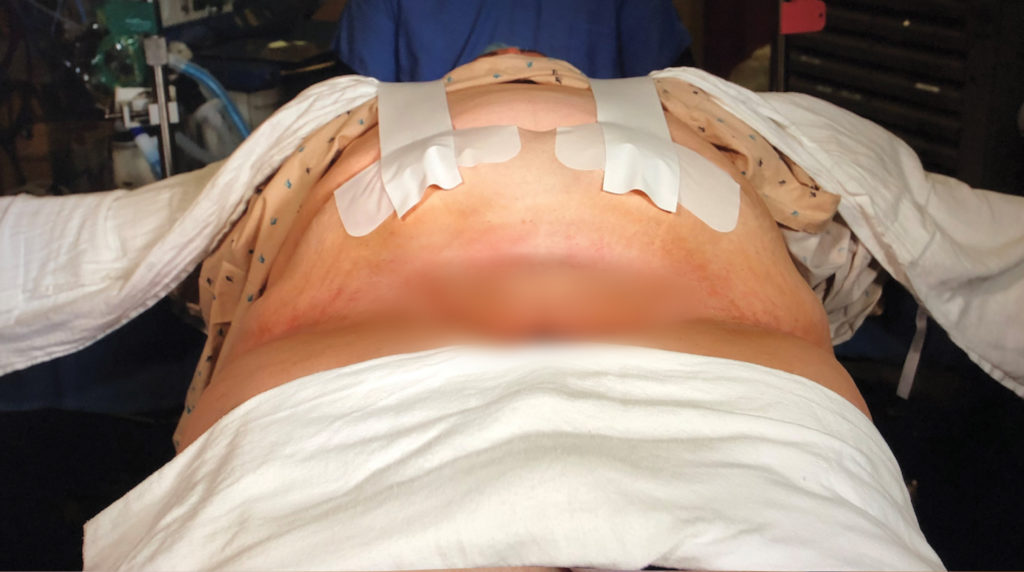 2021_TRS04_PanniPRbrochure14x8_5_Letter_Landscape_INSIDE